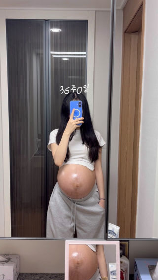 임신 전 39키로 였던 임산부의 만삭 배크기🤰🏻
 
 36주 진입한 지금은 현재 50키로! 
 
 튼살오일, 크림, 미스트 정말 열심히 발랐지만 33주부터 
 하나둘씩 생기더니 지금은 다 터 버렸어요…🥲
 잘 트는 체질이라 어느정도 각오는 하고 있었지만 막상 보니
 너무 속상하더라구요.. 배도 너무 빵빵해져서 여기서 더 나올수가
 있나 싶을정도로 빵빵해졌어요😂 
 이제 D-27일이니 조금만 더 버텨보아요🥹
 
 #만삭 #임산부 #출산 #예비딸맘 #임신기록