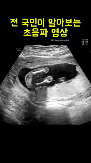 의사가 말 안 해도 다 안다는 그 영상 ㅋㅋㅋ
 
 #말띠아기 #둘째는사랑입니다 #아기스타그램 #초음파 #적토마띠